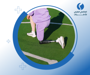 أسعار الأطراف الصناعية