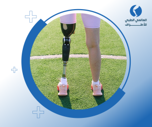 مميزات الأطراف الصناعية