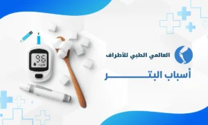 أسباب البتر