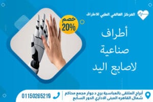 أطراف صناعية لاصابع اليد 1