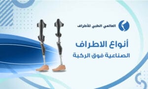أنواع الاطراف الصناعية فوق الركبة