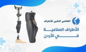 الاطراف الصناعية في الاردن