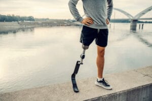مضاعفات بتر إصبع القدم السكري