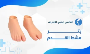 بتر مشط القدم