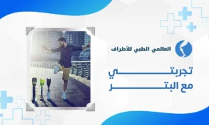 تجربتي مع البتر