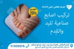 تركيب اصابع صناعية لليد والقدم 150x100 1