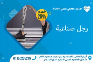 تركيب رجل صناعية