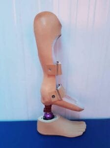 تشوهات خلقيه تشوهات خلقيه 224x300 1