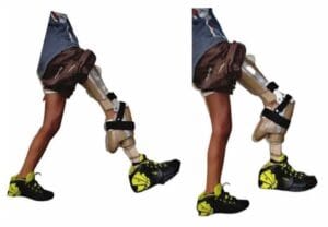 تشوهات خلقيه تشوهات خلقيه