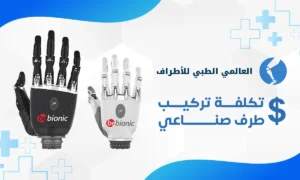 تكلفة تركيب طرف صناعي