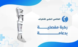 ركبة مفصلية بدعامة