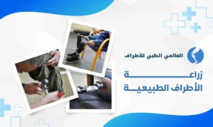 زراعة الأطراف الطبيعية