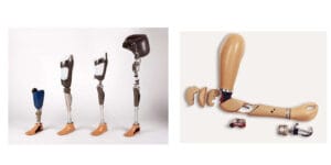 مميزات-وعيوب-الأطراف-الصناعية