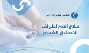 علاج الام اطراف الاصابع القدم