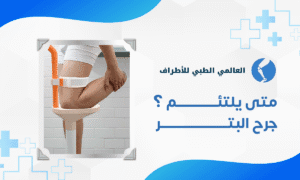 متى يلتئم جرح البتر