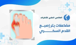 مضاعفات بتر إصبع