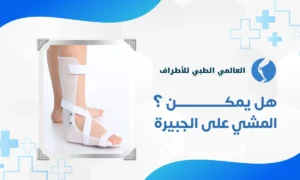 هل يمكن المشي على الجبيرة 1