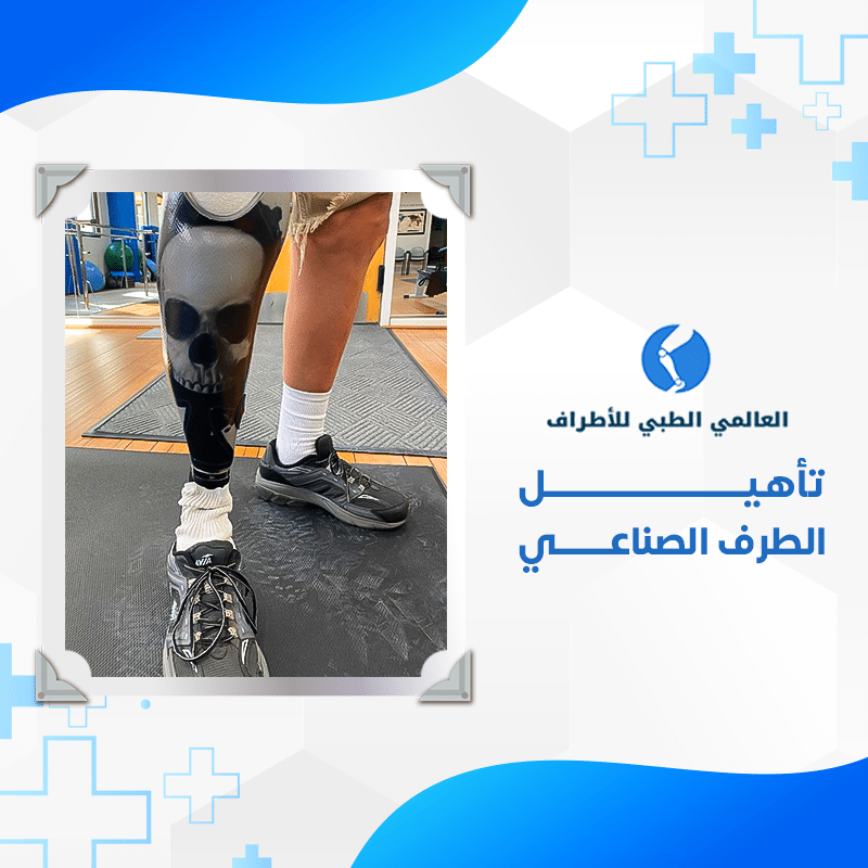 الأطراف خدمة 13