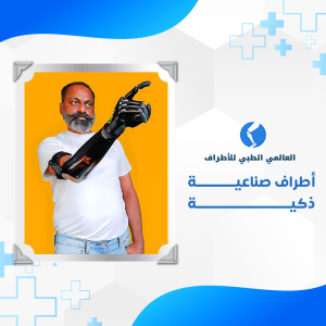الأطراف خدمة 2