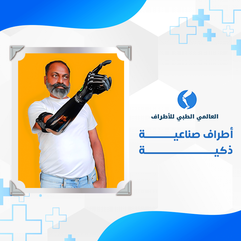 الأطراف خدمة 2