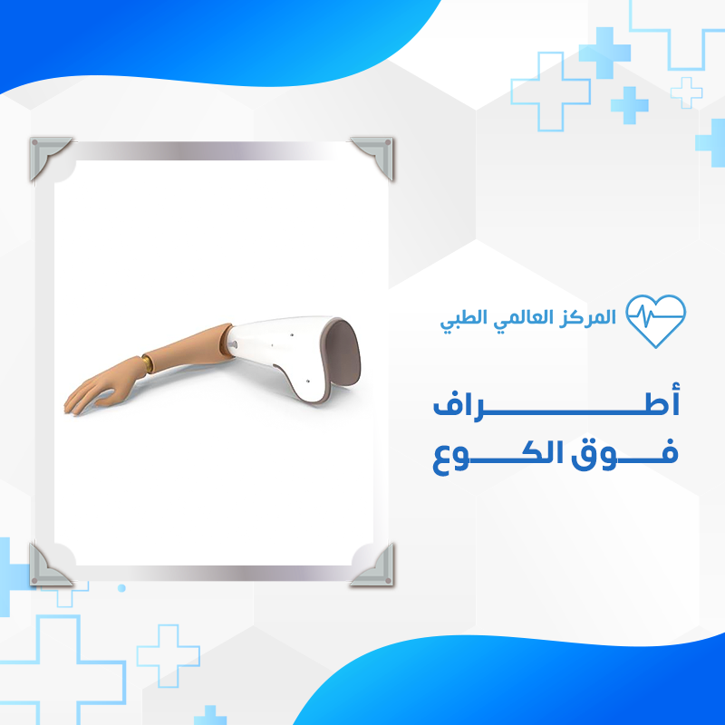 الأطراف خدمة 1