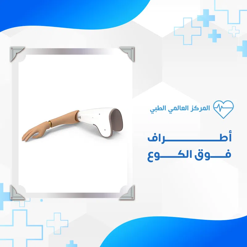 الأطراف خدمة 1