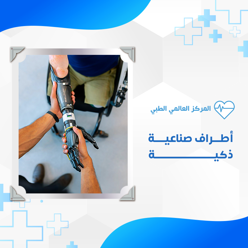 الأطراف خدمة3