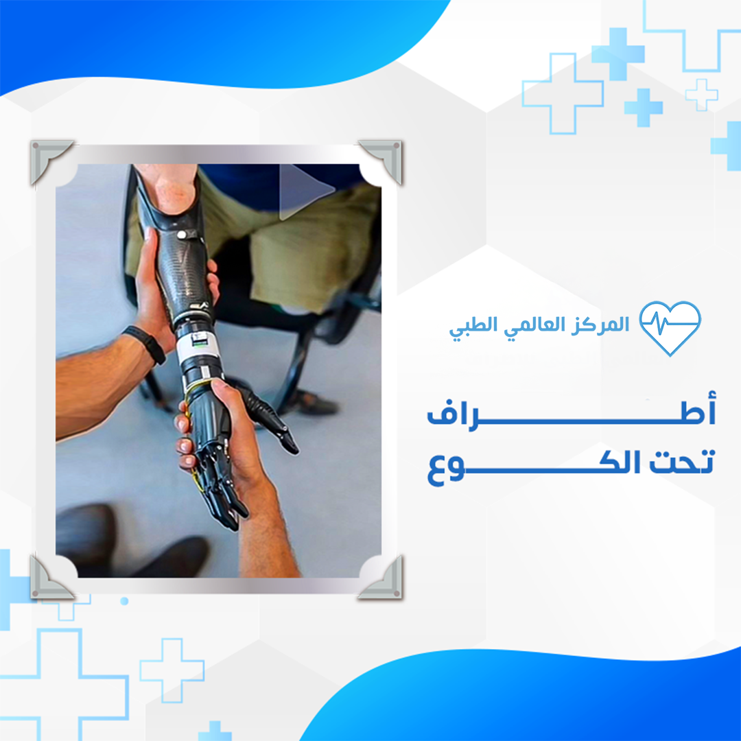 خدمة الأطراف2