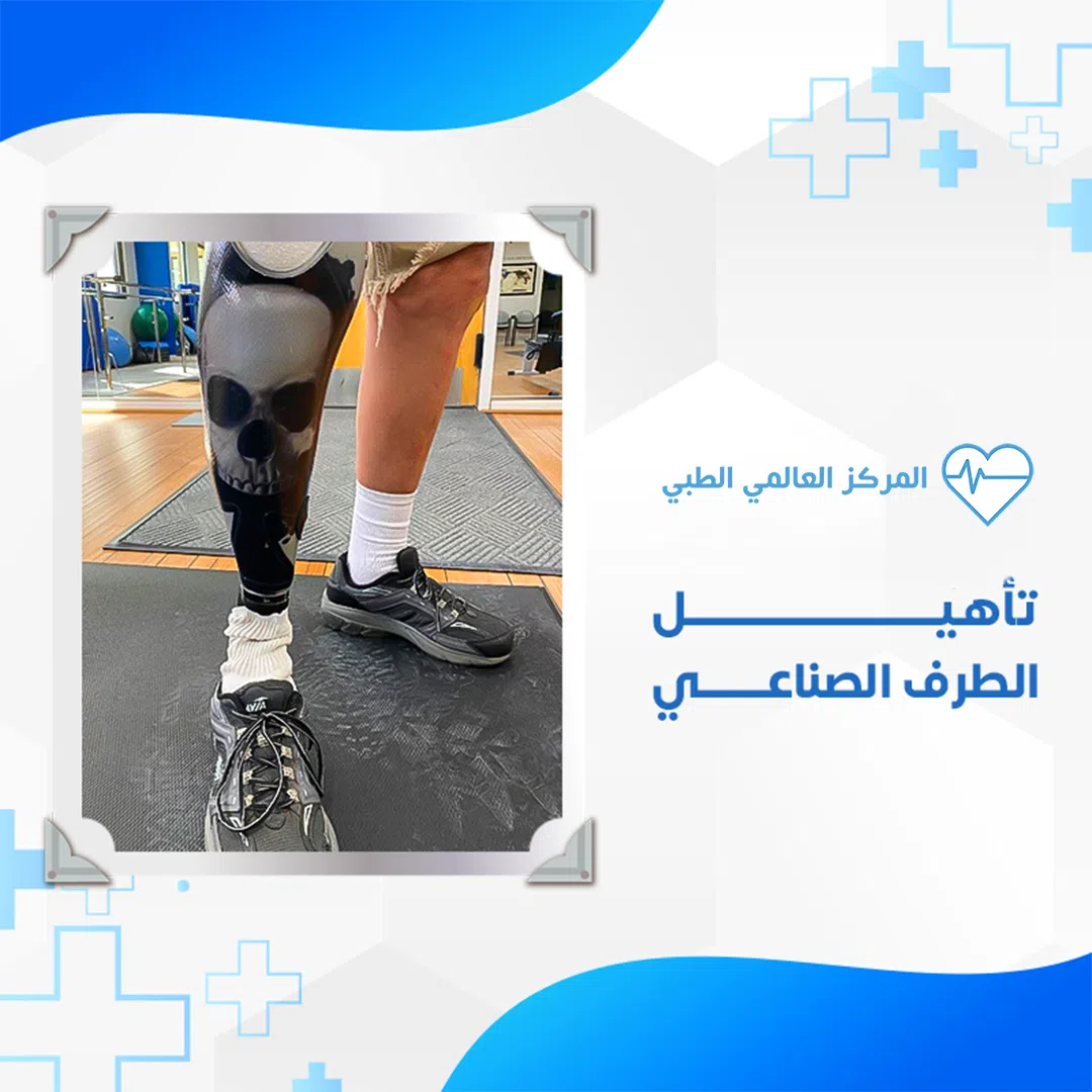 اسعار الرجل الصناعية