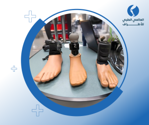 أنواع الأطراف الصناعية والأجهزة التعويضية