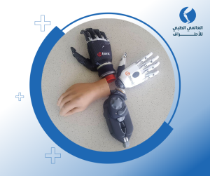 بيع الاطراف الصناعية فوق الكوع