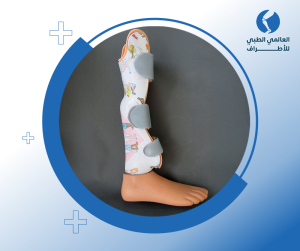 تركيب الأطراف الصناعية السفلية