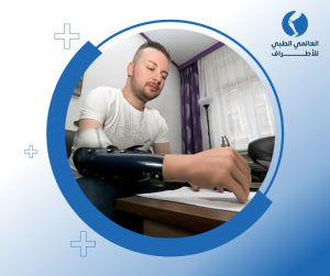 تركيب الطرف الصناعي العلوي وتأهيل المريض