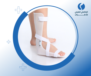 تركيب جبائر الأطفال البلاستيكية