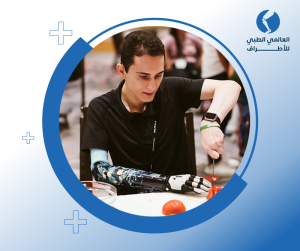 مزايا الأطراف الصناعية العلوية الحديثة