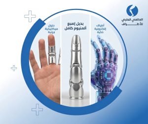 بدائل زراعة أصابع اليد
